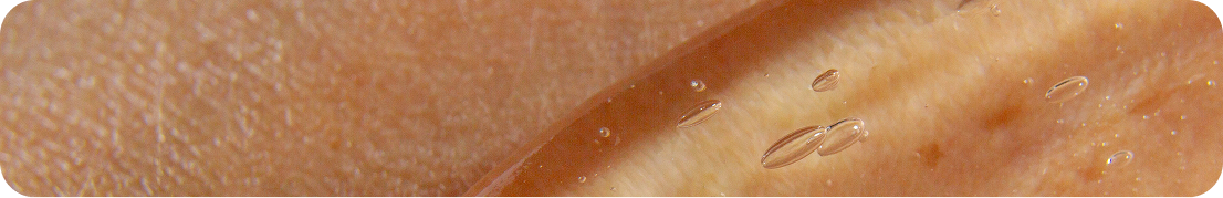 RESTORATION